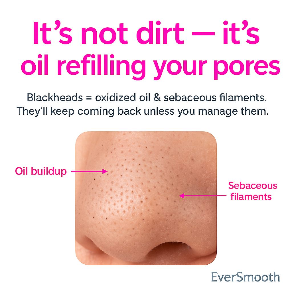 Blackhead Remover Pore Vacuum Face