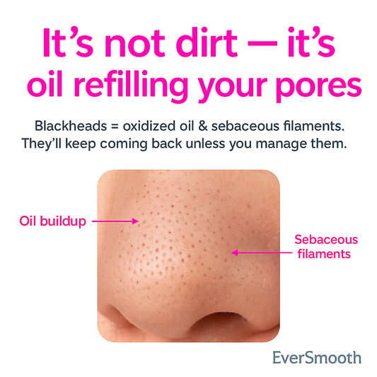 Blackhead Remover Pore Vacuum Face