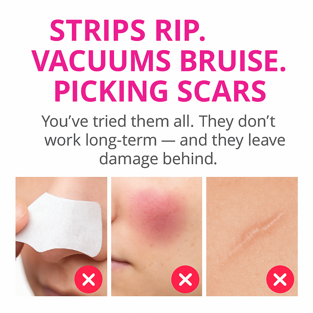 Blackhead Remover Pore Vacuum Face