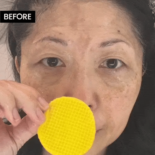 Kojic Buy 1 Get 1 Free Turmeric & Kojic Acid (60×2) Cleansing Pads  (100% Geniuan)